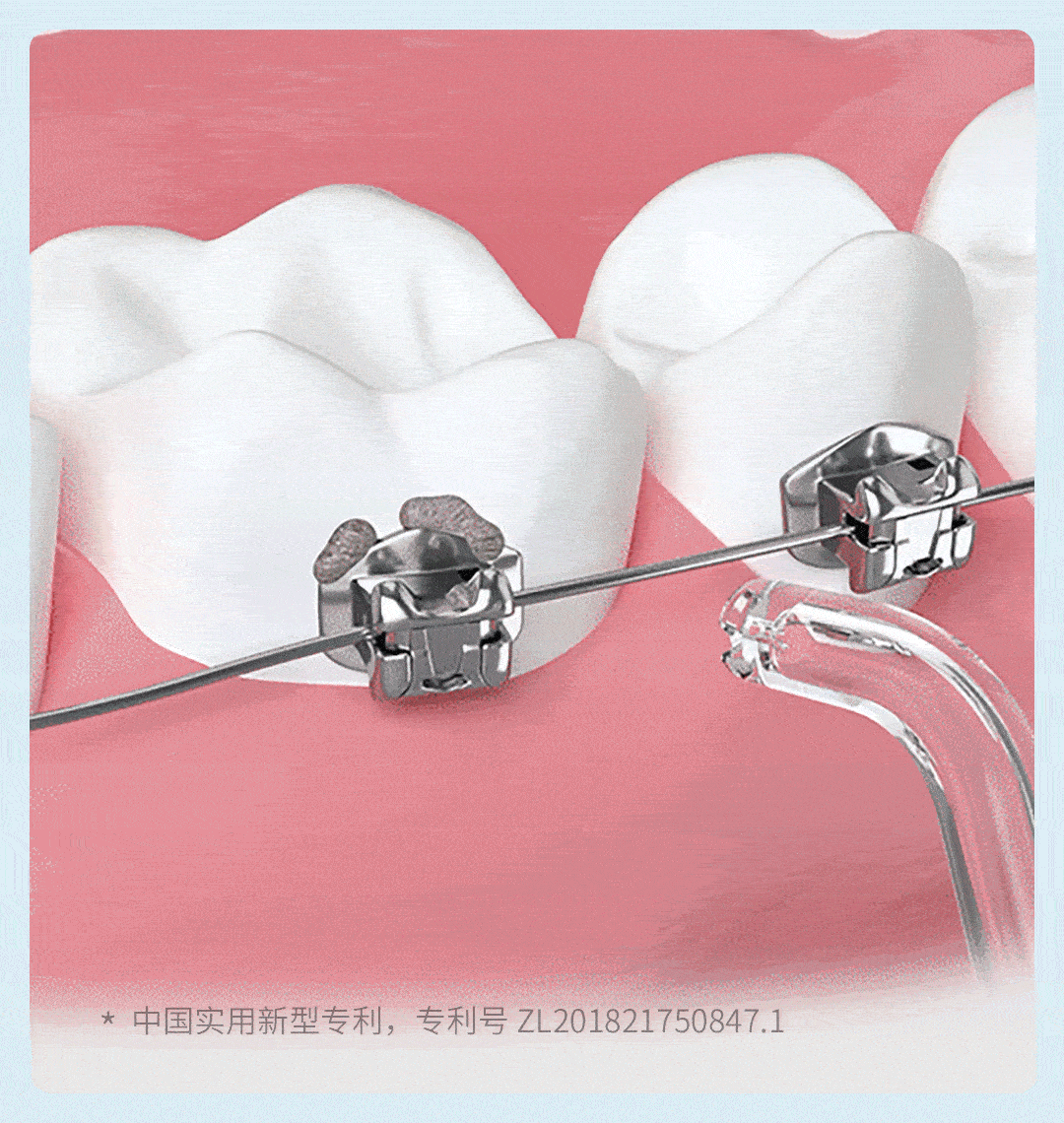ENPULY Oral Irrigator M6 Plus Portable Dental Irrigator bucal Ultrasonic waterpulse teeth Oral Tooth Cleaner Teeth Water Flosser