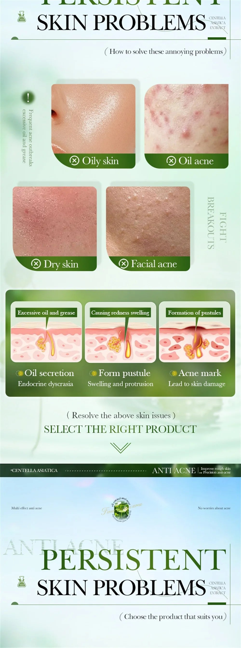 Salicylic Acid Acne Treatment Face Cream Repair Pimple Spots Deep Cleaning Pore Anti-acne Scar Oil Control Moisturizer Skin Care