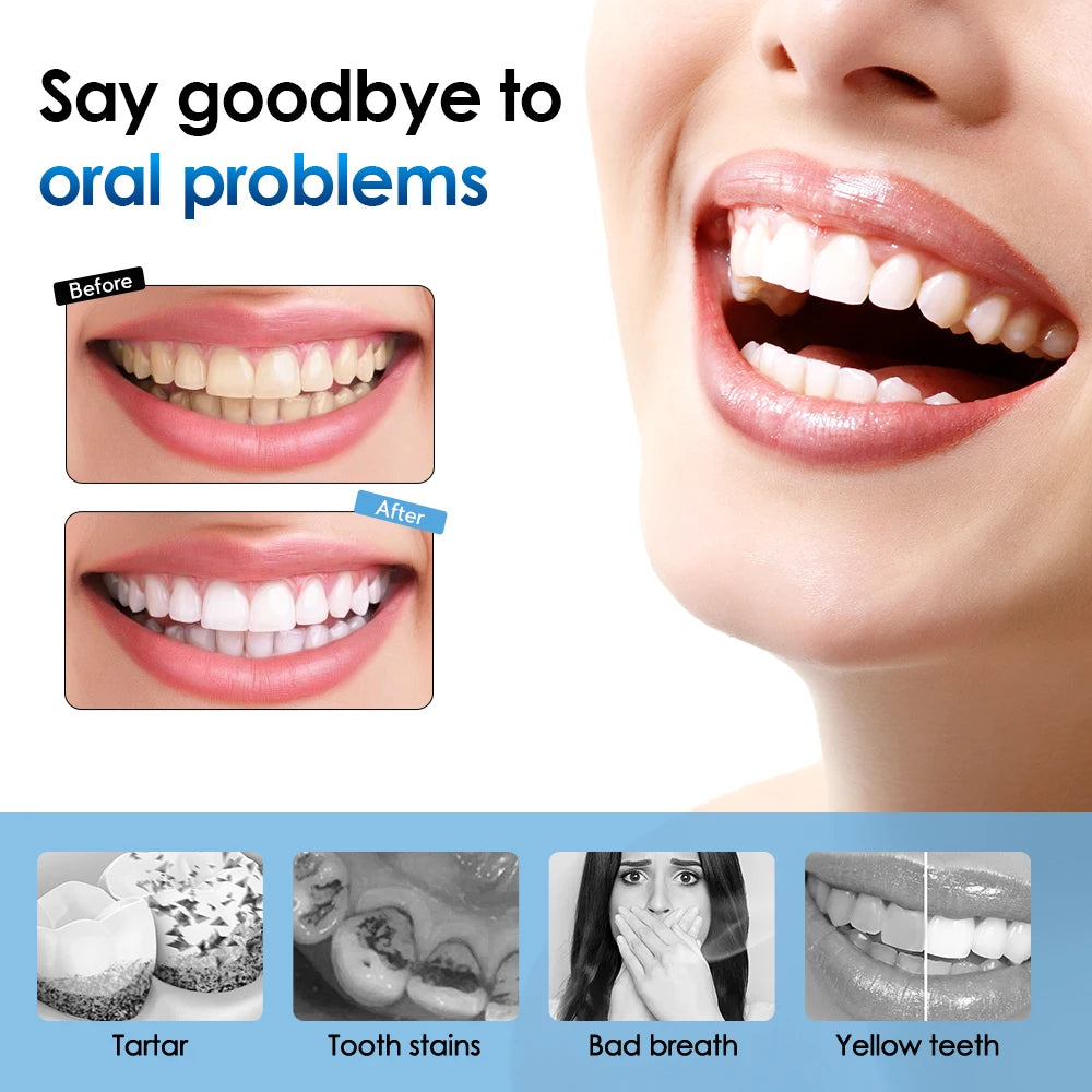 Sonic Electric Toothbrush Teeth Whitening Kit Tooth Whitener Calculus Plaque Tartar Remover Tools Cleaner Stain Oral Care