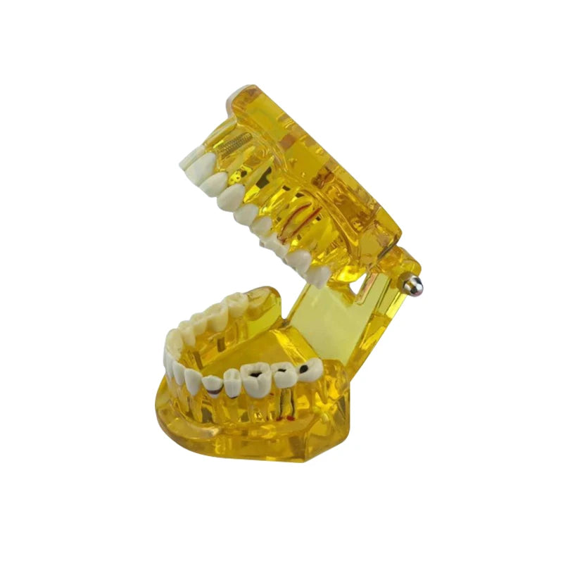 VVDental Teeth Repair Model Disease Teeth Model for Dentist Student Practice Training Studying Oral Medical Dentistry Tools