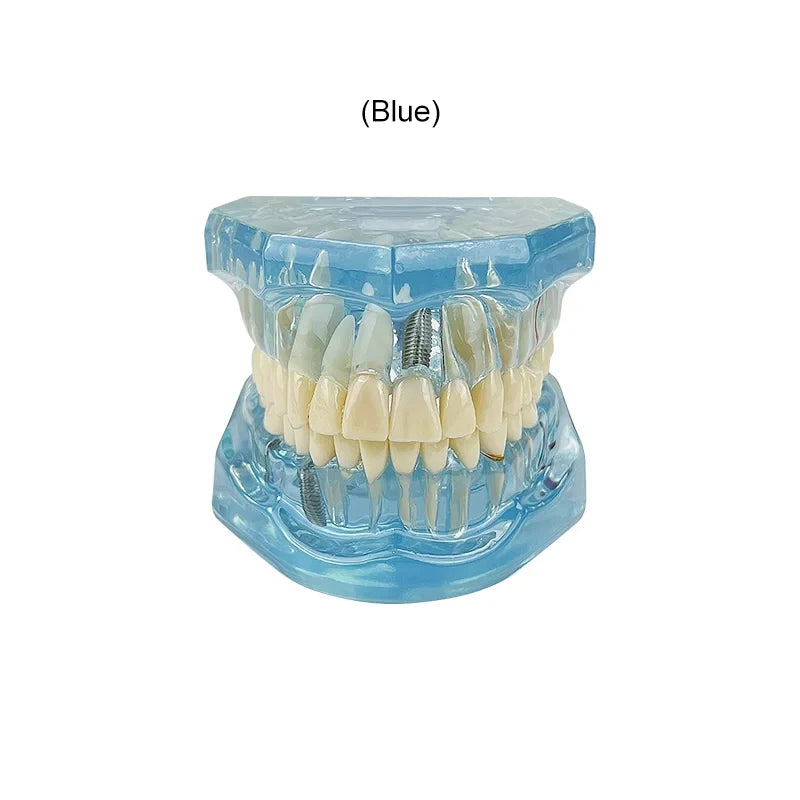 VVDental Teeth Repair Model Disease Teeth Model for Dentist Student Practice Training Studying Oral Medical Dentistry Tools