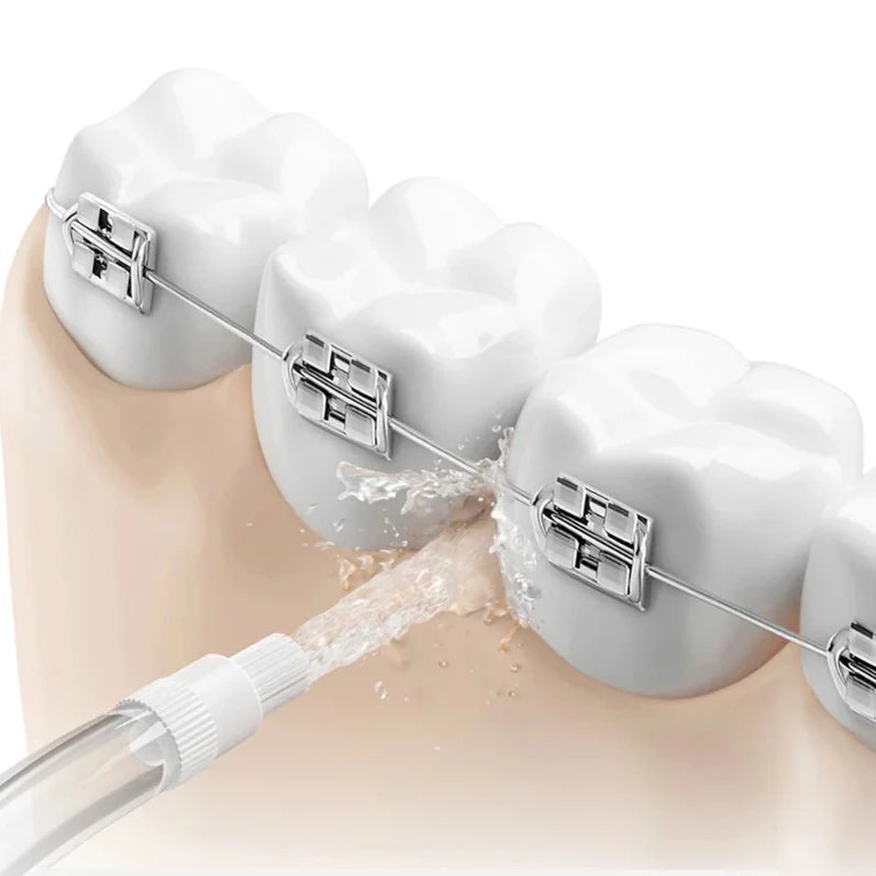 Nozzles For all Xiaomi Mijia Oral Irrigator F400,F300 MEO701 702 and Other Mijia Water Flosser Replacement Nozzles