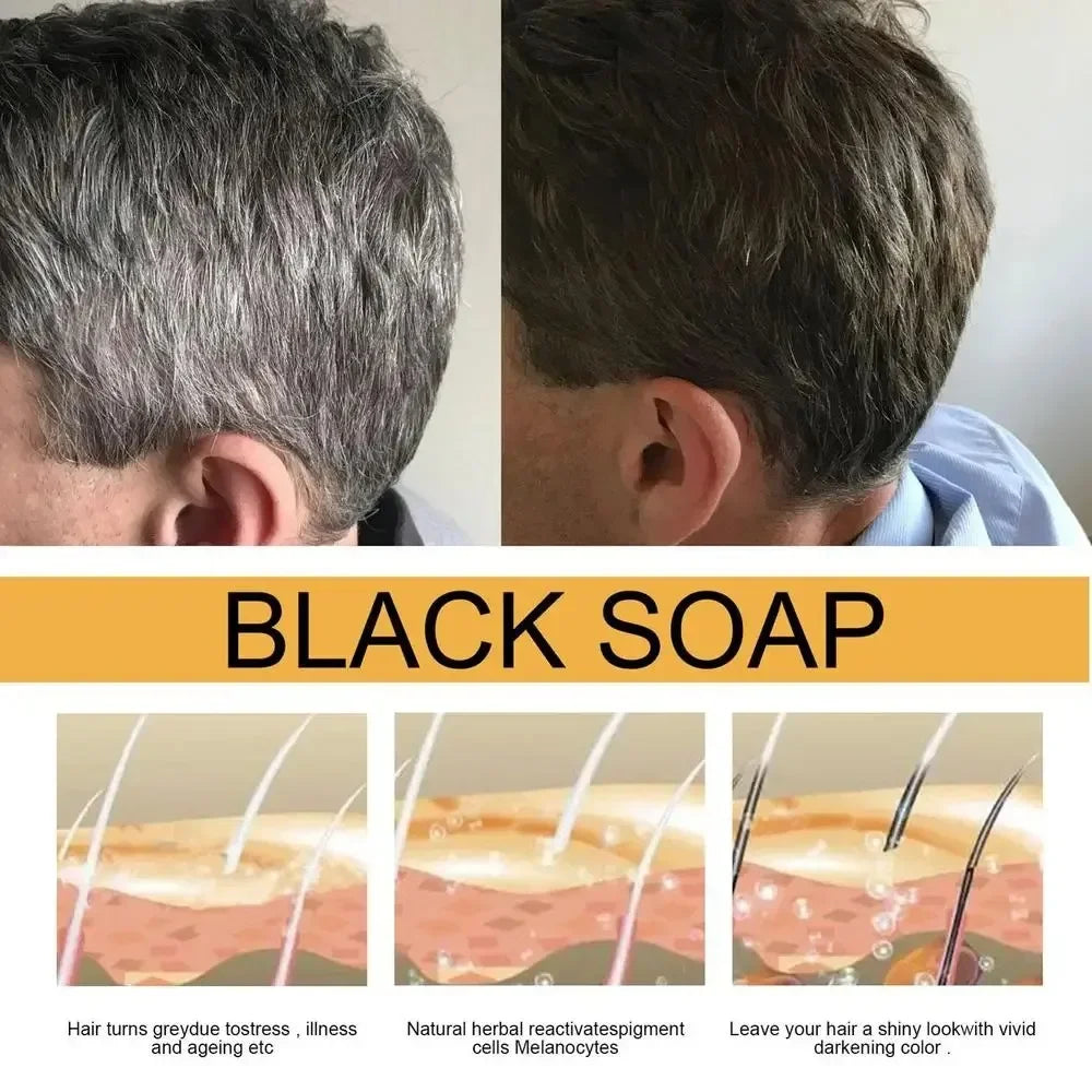Polygonum Multiflorum Black Hair Soap Darkening Shampoo Bar Repair Gray White Color Dye Face Hair Body Shampoo For Man Women