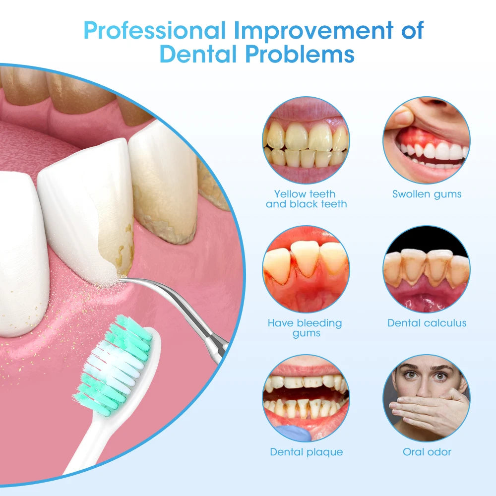 Sonic Electric Toothbrush Teeth Whitening Kit Tooth Whitener Calculus Plaque Tartar Remover Tools Cleaner Stain Oral Care
